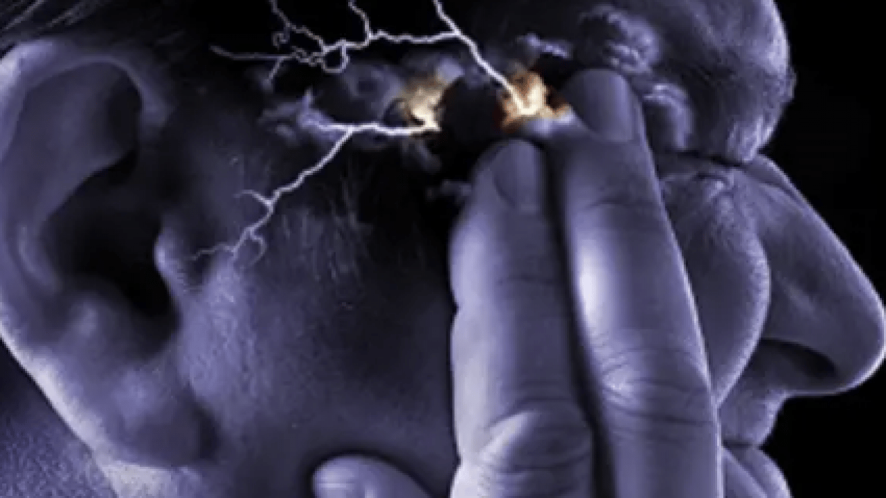 Foto - Migrenli beynin ‘filtre’ sırrı çözüldü! Türk bilim insanlarından dünya çapında keşif