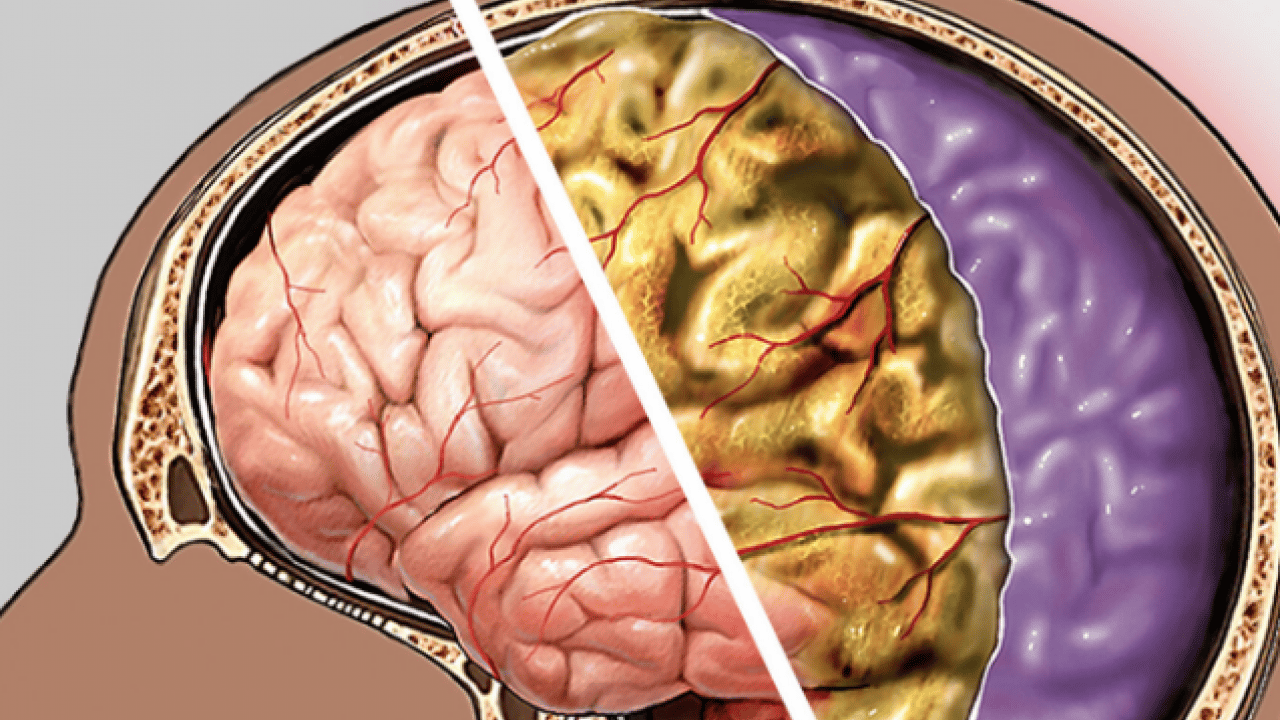 Foto - Mikrobiyoloji uzmanından uçak seyahati yapanlara uyarı! Yok yere bu hataya düşmeyin...
