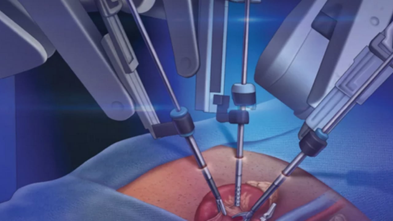 Foto - Milimetrik hareket kabiliyeti ve titreşimsiz enstrümanlar... Robotik cerrahide kişiselleştirilmiş tedavi!