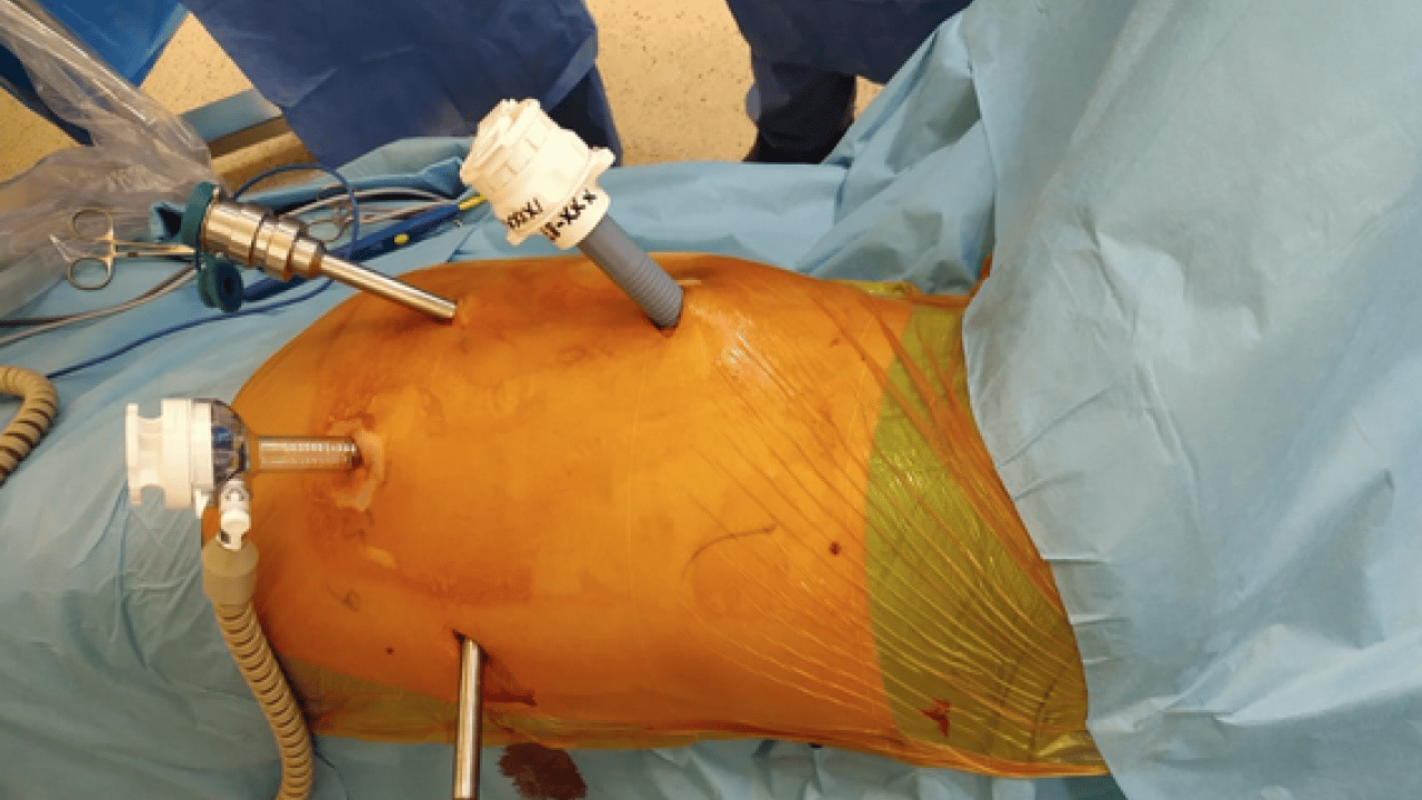 Milimetrik hareket kabiliyeti ve titreşimsiz enstrümanlar... Robotik cerrahide kişiselleştirilmiş tedavi!