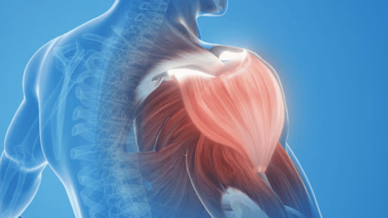 Foto - Miyofasiyal ağrı... Hidrodiseksiyon ile ağrıya değil nedene müdahale ediyoruz