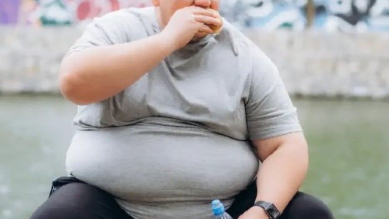 Foto - Modern çağın hastalığı olarak biliniyor! İşte obeziteden kurtulmanın etkili ve doğal yolları
