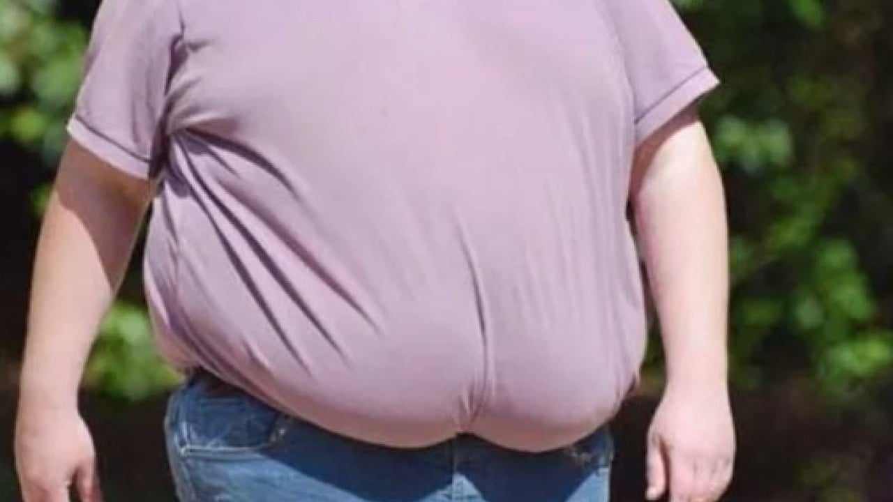 Foto - Modern çağın hastalığı olarak biliniyor! İşte obeziteden kurtulmanın etkili ve doğal yolları