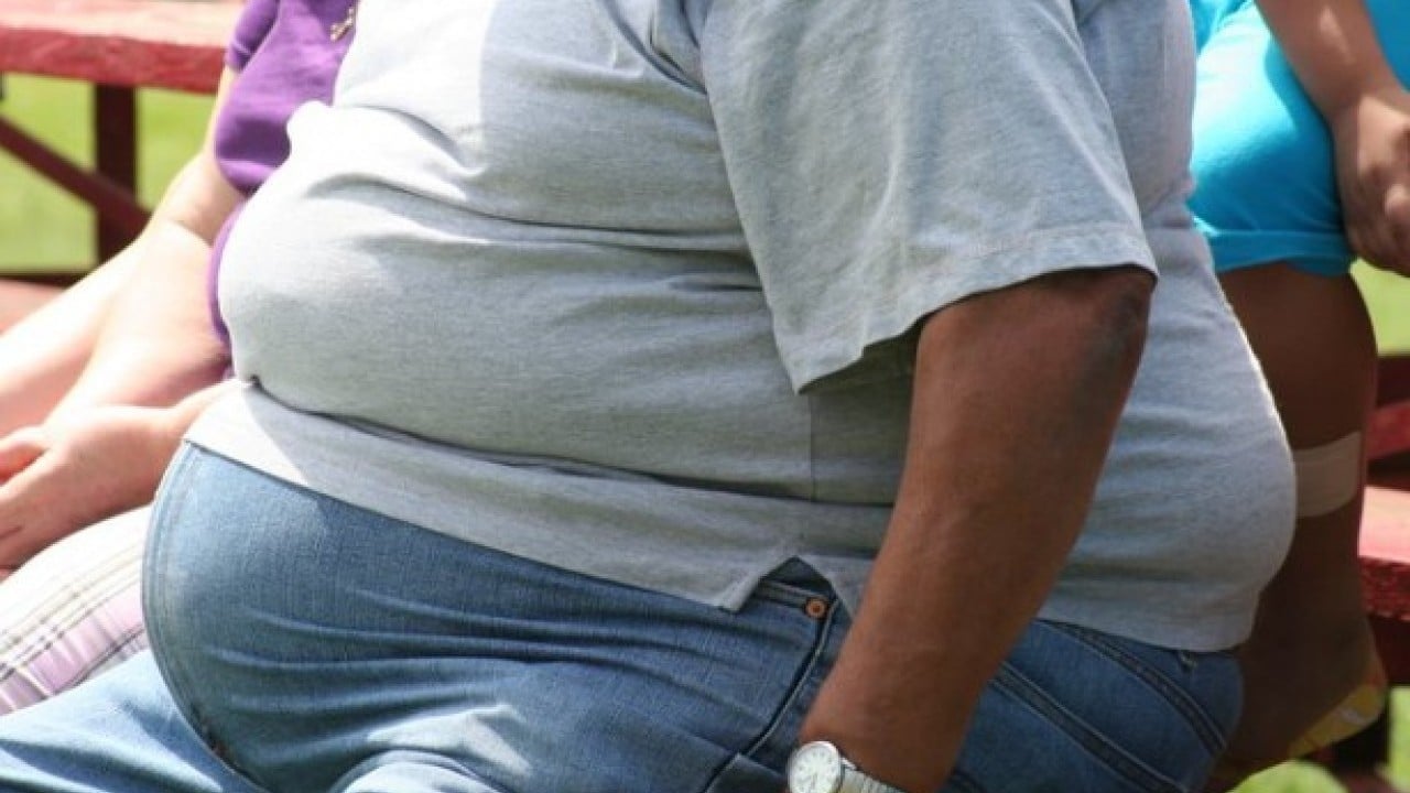 Foto - Modern çağın hastalığı olarak biliniyor! İşte obeziteden kurtulmanın etkili ve doğal yolları