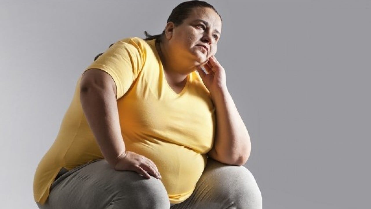 Foto - Modern çağın hastalığı olarak biliniyor! İşte obeziteden kurtulmanın etkili ve doğal yolları