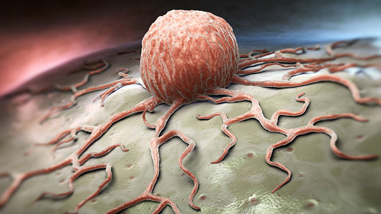 Foto - Daha fazla egzersiz yapmak kanser karşı riskini azaltır! Resmen yeniden araştırdılar