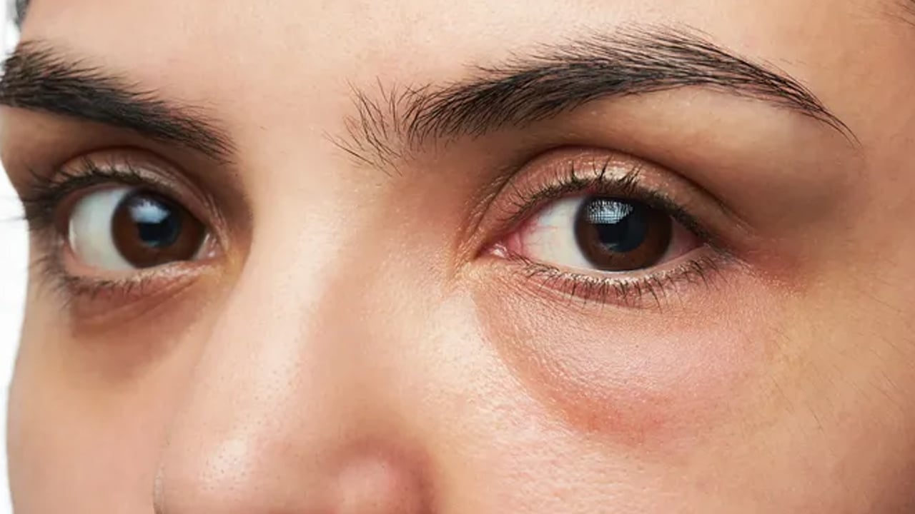 Foto - Müthiş fırsat: Kremlere servet ödemeye son! Göz altı torbalarını anında siliyor! Gençleştiren formülü size anlatıyoruz