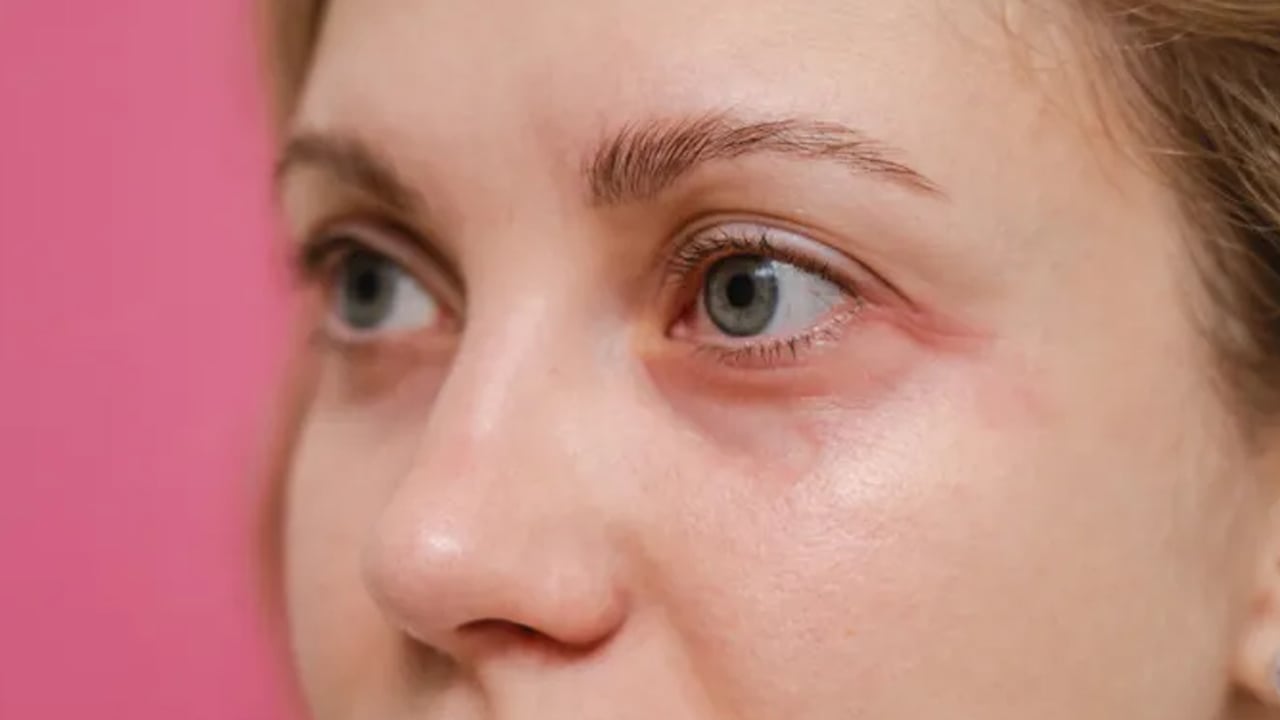 Foto - Müthiş fırsat: Kremlere servet ödemeye son! Göz altı torbalarını anında siliyor! Gençleştiren formülü size anlatıyoruz