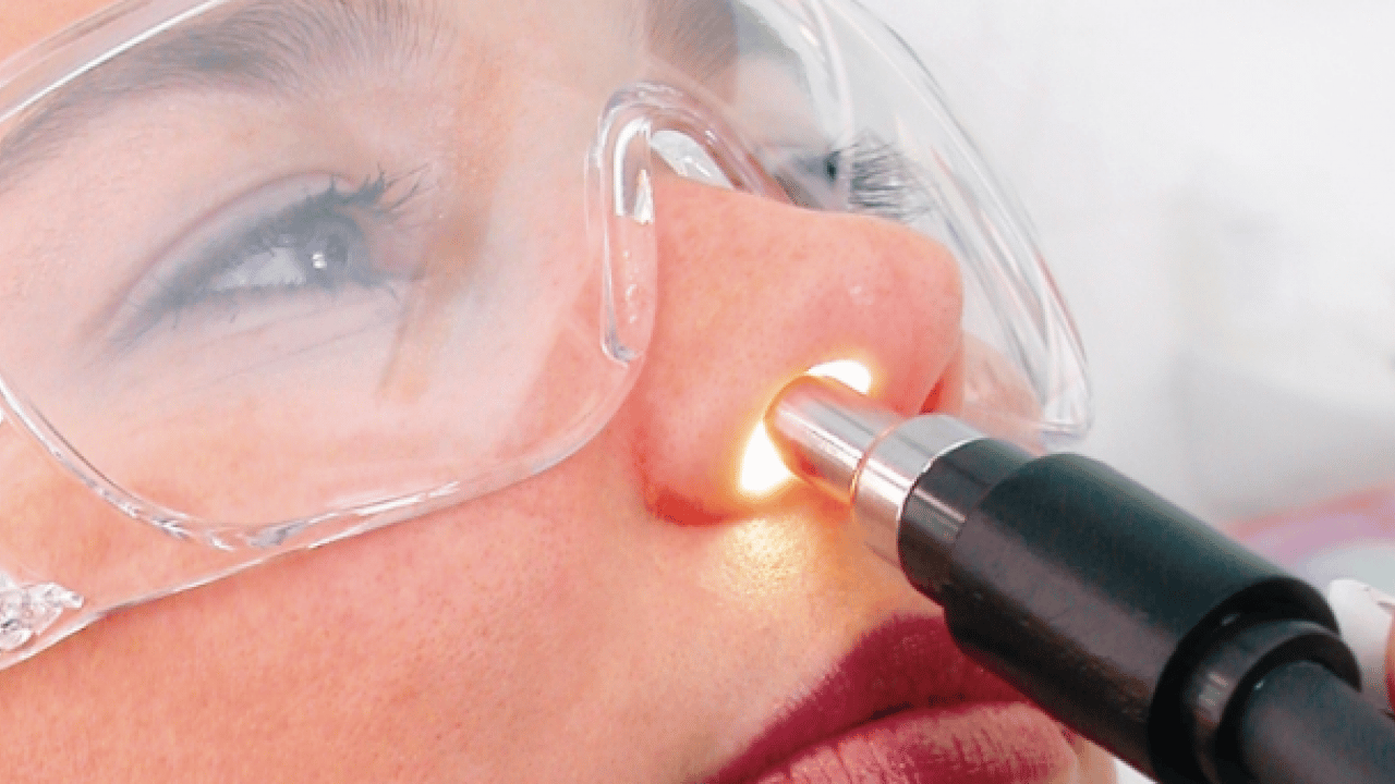 Foto - Nazal Polip olabilir korkusu! Uzun süren burun tıkanıklığı...