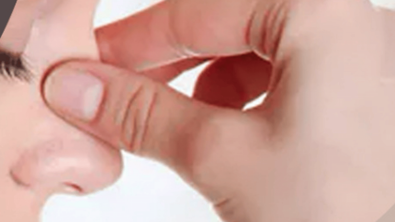 Foto - Nazal Polip olabilir korkusu! Uzun süren burun tıkanıklığı...