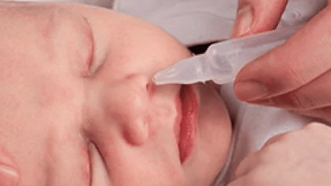 Foto - Nazal Polip olabilir korkusu! Uzun süren burun tıkanıklığı...