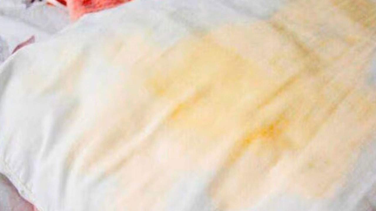 Foto - Ne yapsanız da temizlenmiyor mu? İşte sararan yatakları pırıl pırıl yapacak o yöntem