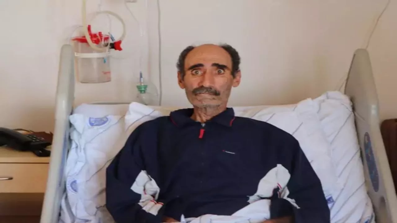 Nefes darlığı şikayetiyle gitti, akciğerinden çıkan şey 30 yıllık cerrahın bile ağzını açık bıraktı