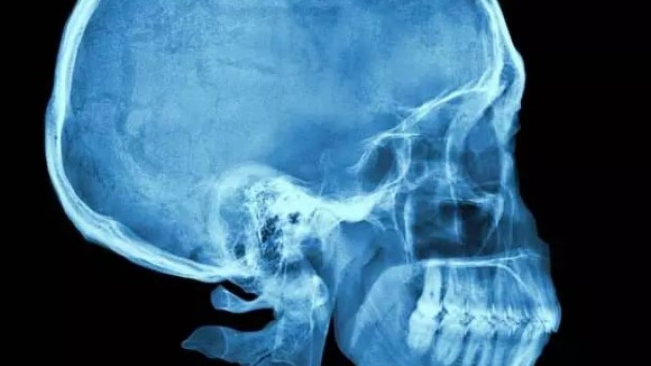 Foto - Neye niyet neye kısmet: Hepsi yanlışlıkla icat edildi!