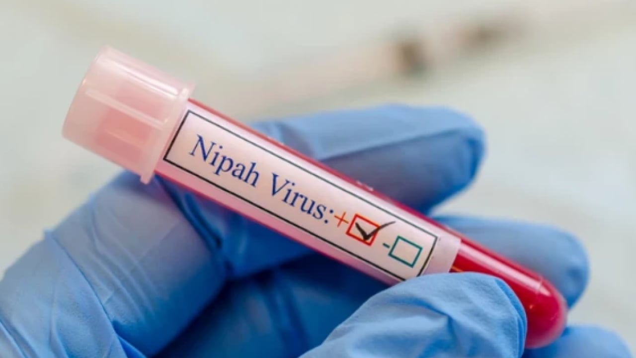 Foto - Ölüm oranı korkuttu: İşte Nipah virüsünün 3 belirtisi!