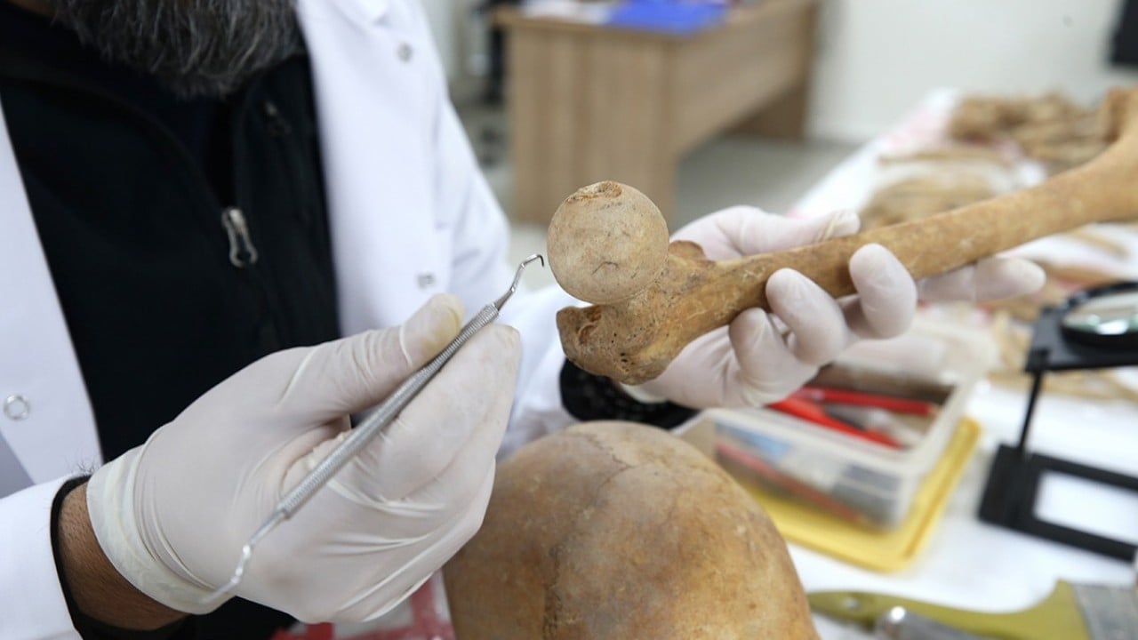 Foto - O ilimizde fışkıran tarih gün yüzüne çıkarılıyor: 72 insan iskeleti masaya yatırıldı…