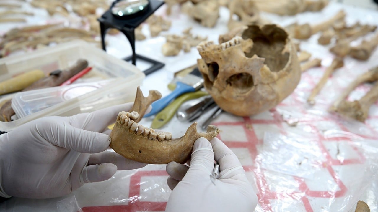 Foto - O ilimizde fışkıran tarih gün yüzüne çıkarılıyor: 72 insan iskeleti masaya yatırıldı…