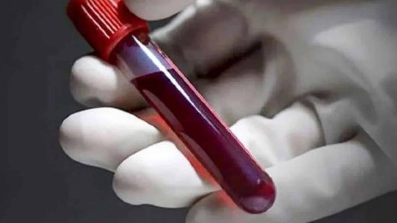 Foto - İşte depresyona en yatkın kan grubu: Damarlarında anksiyete akıyor!