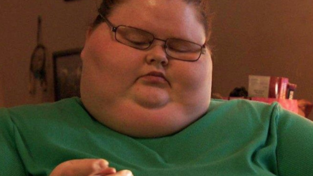 Foto - Obezite uyarısı geldi! Vücudunuzu korumak sizin elinizde artık...