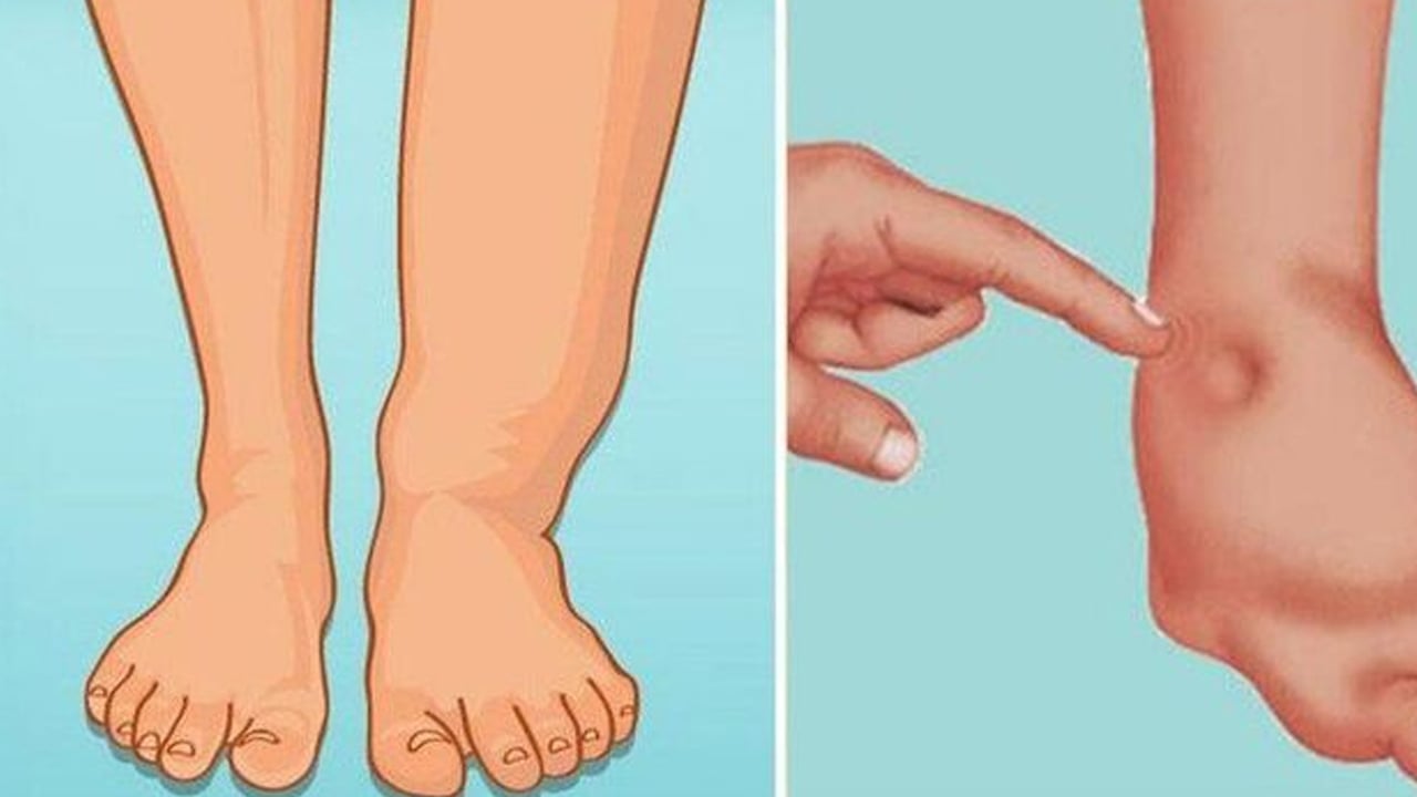 Foto - Ödem ve şişkinliğe son: Size bir anda iyi gelecek, pişman etmeyecek! Yarım asırlık doğal içecek 