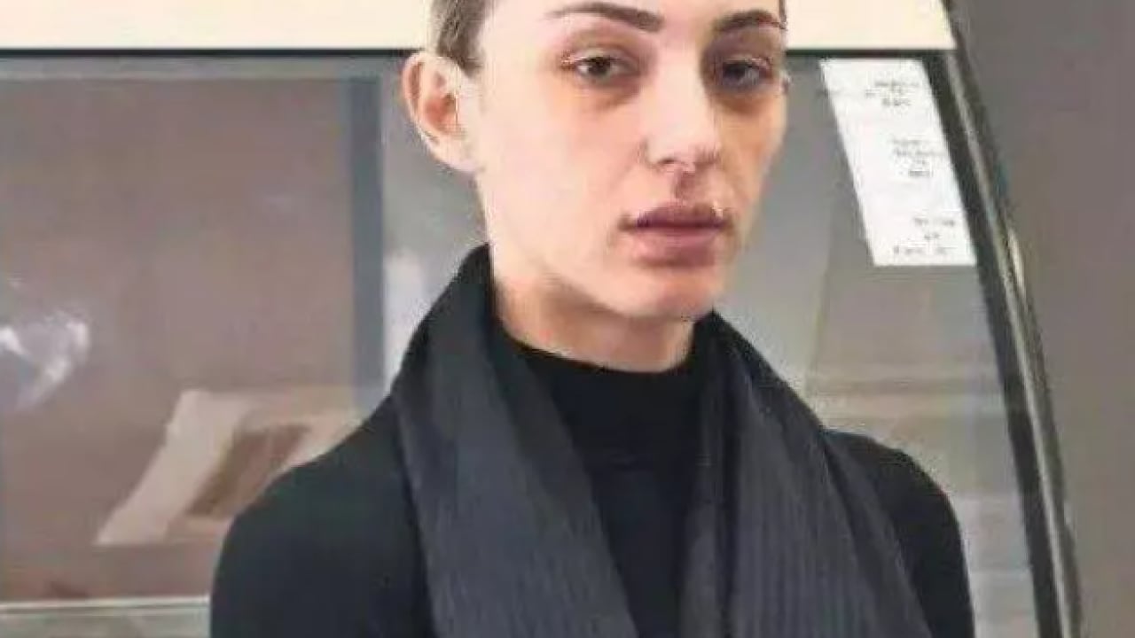 Foto - Sultan Nur Ulu ilk kez açık açık itiraf etti: Gözümün önünde...