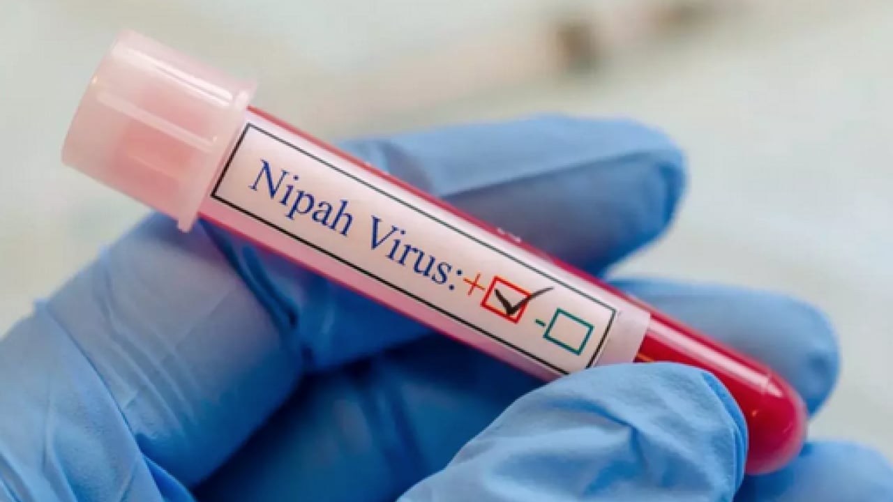 Foto - Ölümcül virüs durmuyor: Profesör açıkladı: 'Nipah virüsü ülkemiz için risk oluşturmuyor'