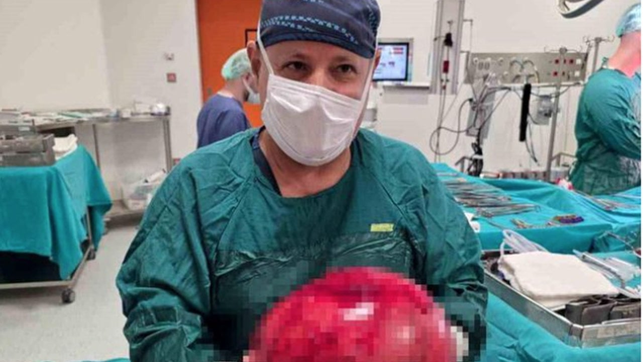 Foto - Onlar da ilk defa karşılaştılar! Halsizlik şikayetiyle gitti, karnından çıkan şey doktorları bile şoke etti