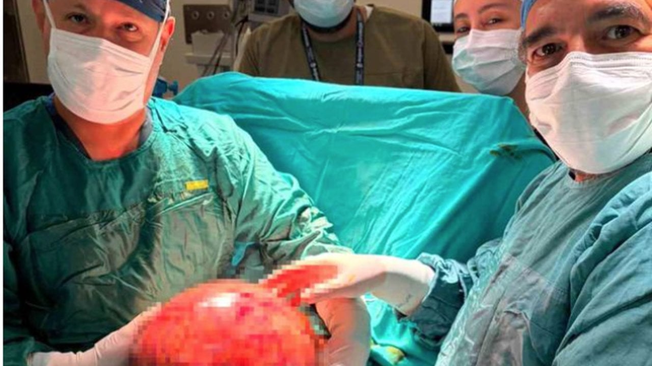 Foto - Onlar da ilk defa karşılaştılar! Halsizlik şikayetiyle gitti, karnından çıkan şey doktorları bile şoke etti