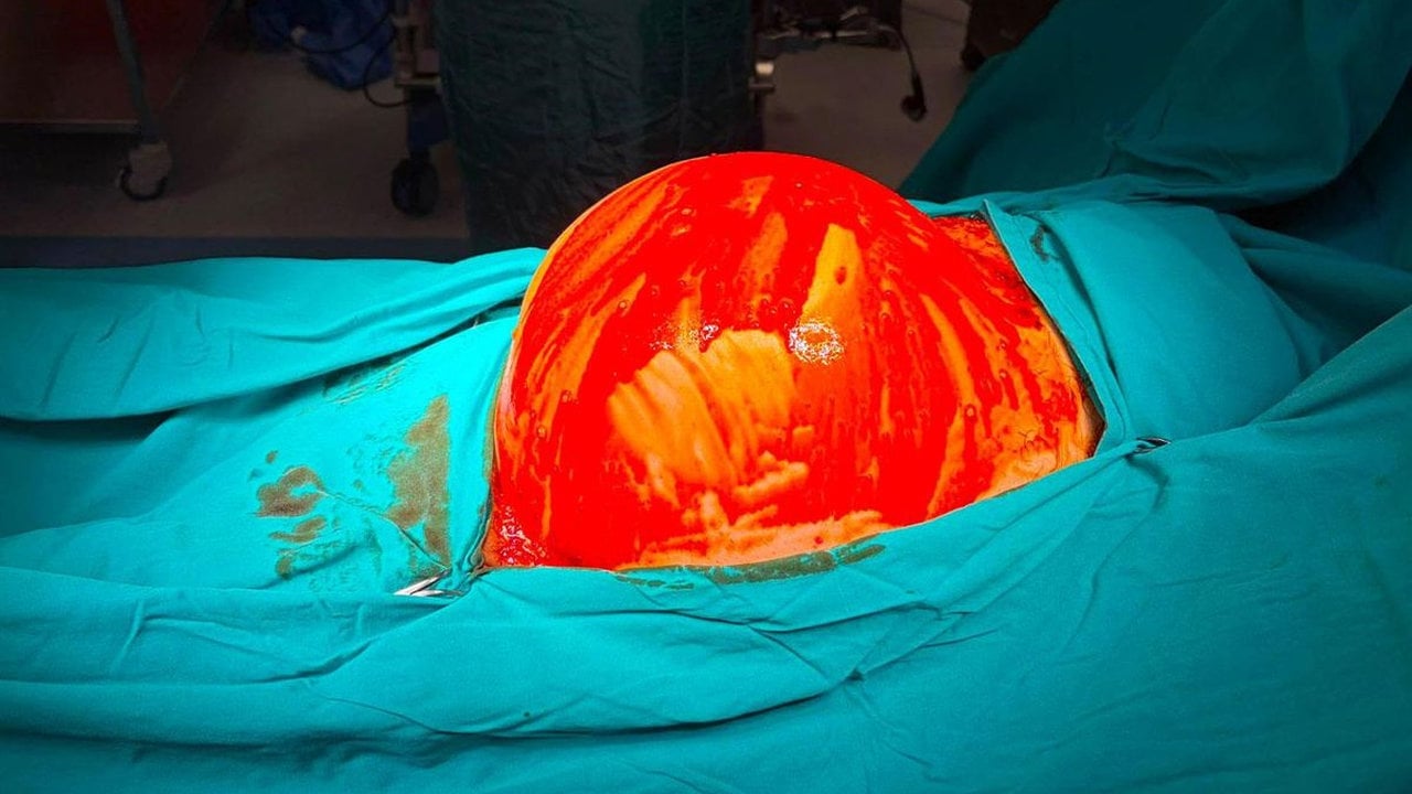 Onlar da ilk defa karşılaştılar! Halsizlik şikayetiyle gitti, karnından çıkan şey doktorları bile şoke etti