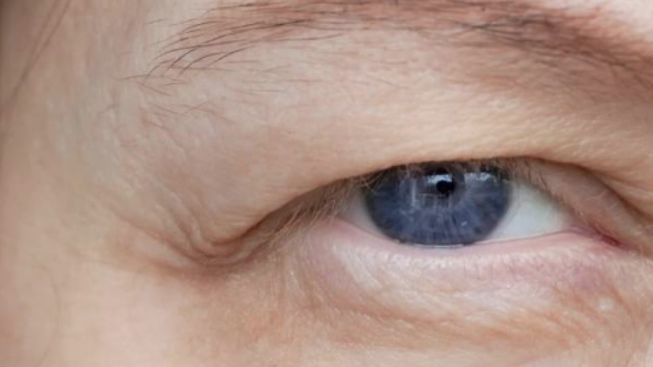 Foto - Op. Dr. açıkladı: Çekici görünen bakışın altında hastalık olabilir