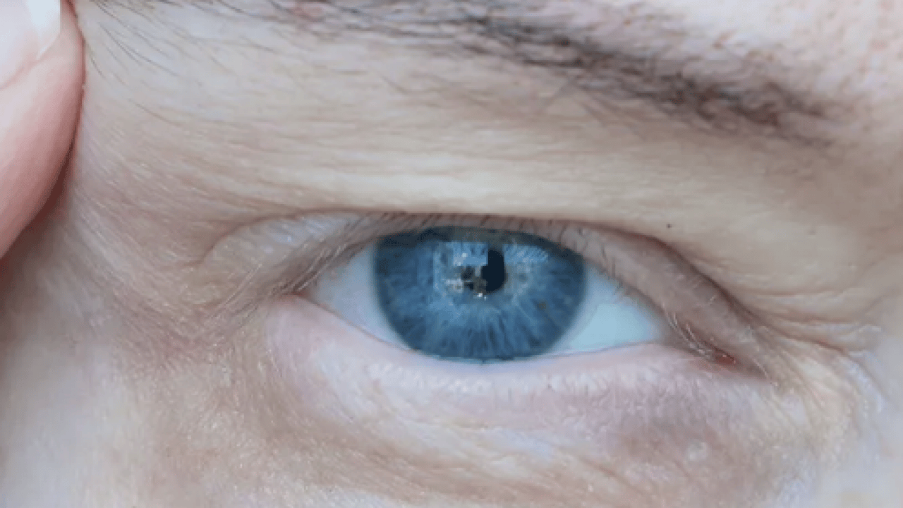 Foto - Op. Dr. açıkladı: Çekici görünen bakışın altında hastalık olabilir