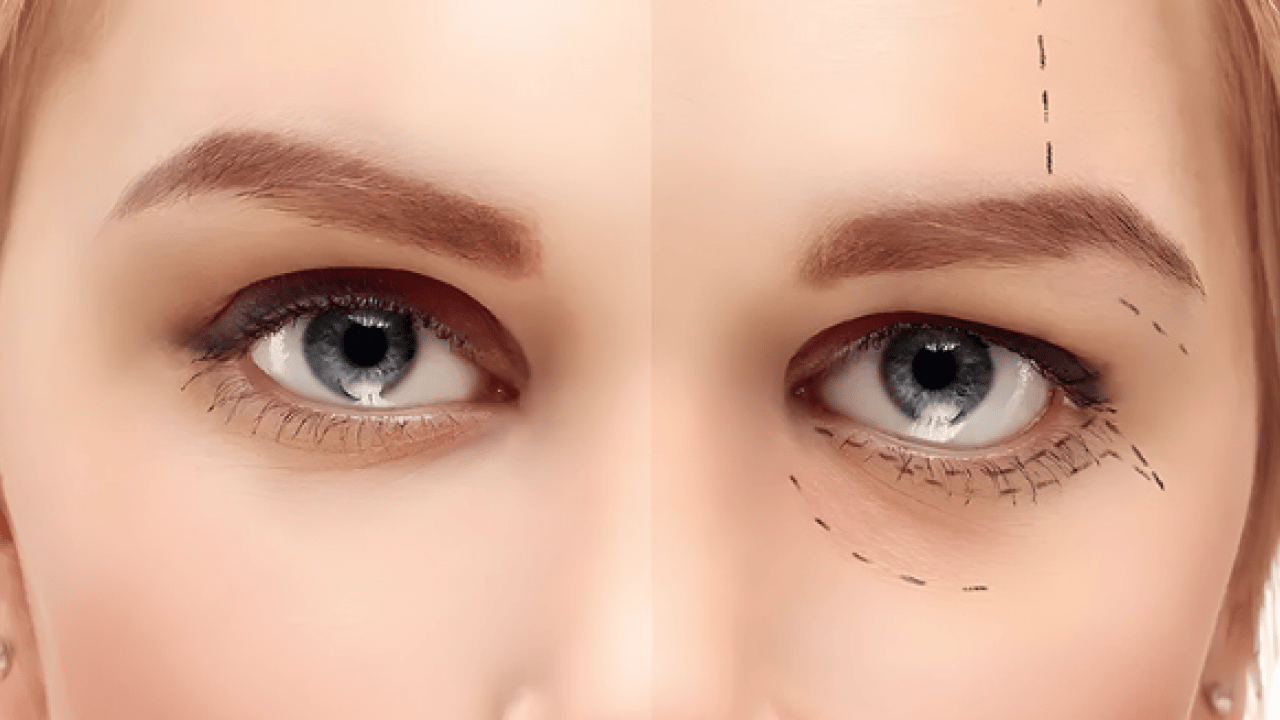 Foto - Op. Dr. açıkladı: Çekici görünen bakışın altında hastalık olabilir