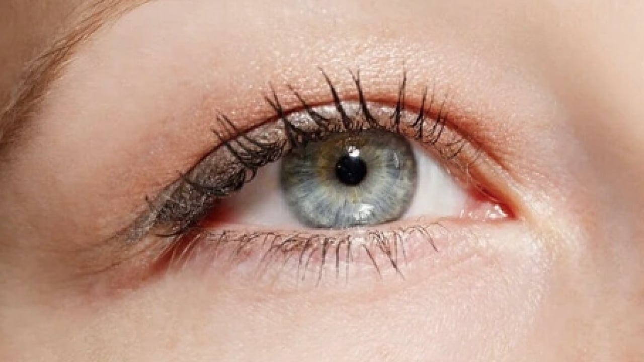 Foto - Op. Dr. açıkladı: Çekici görünen bakışın altında hastalık olabilir