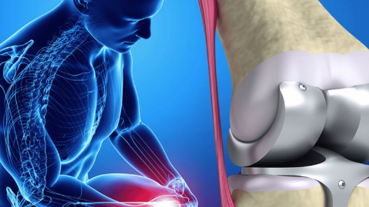 Foto - Ortopedi uzmanı konuştu... Diz ağrısını hafife almayın: Sinsi tehlike menisküs kök yırtıkları