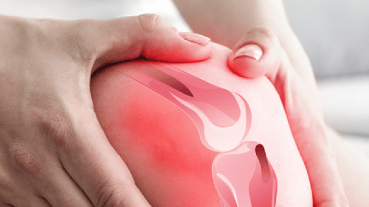 Foto - Ortopedi uzmanı konuştu... Diz ağrısını hafife almayın: Sinsi tehlike menisküs kök yırtıkları