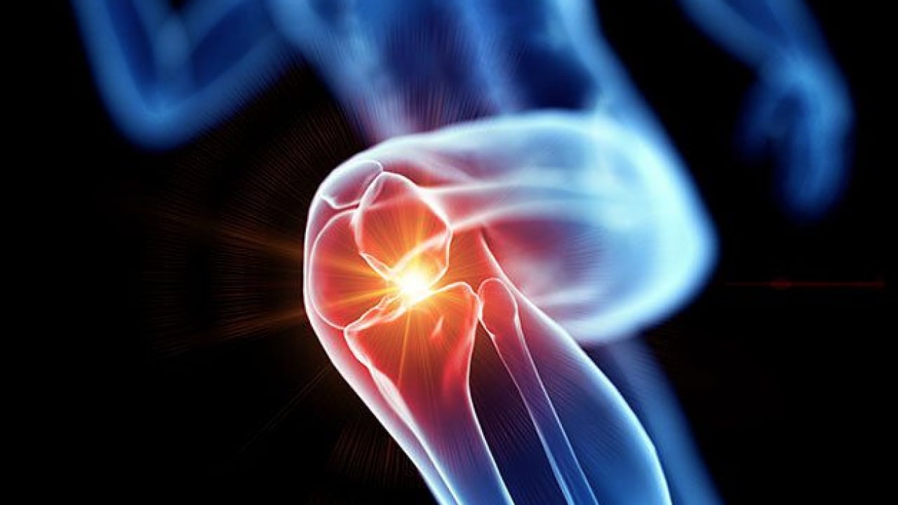 Ortopedi uzmanı konuştu... Diz ağrısını hafife almayın: Sinsi tehlike menisküs kök yırtıkları