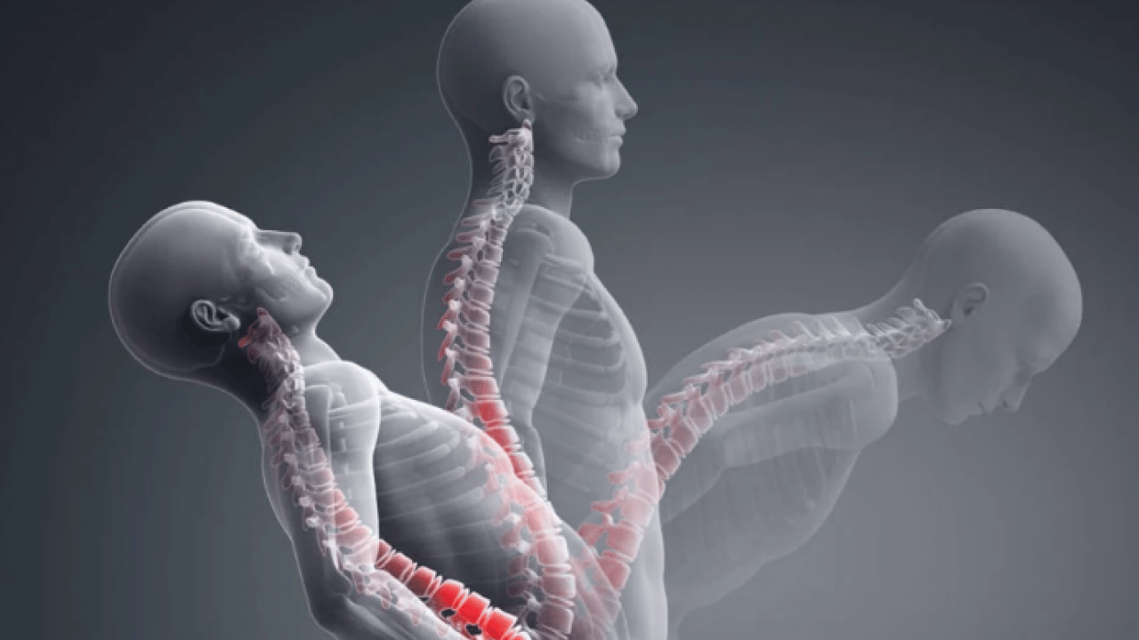 Foto - Ortopedi ve Travmatoloji Uzmanı uyarıyor: Bel ağrısı toplumun yüzde 80'ini etkiliyor