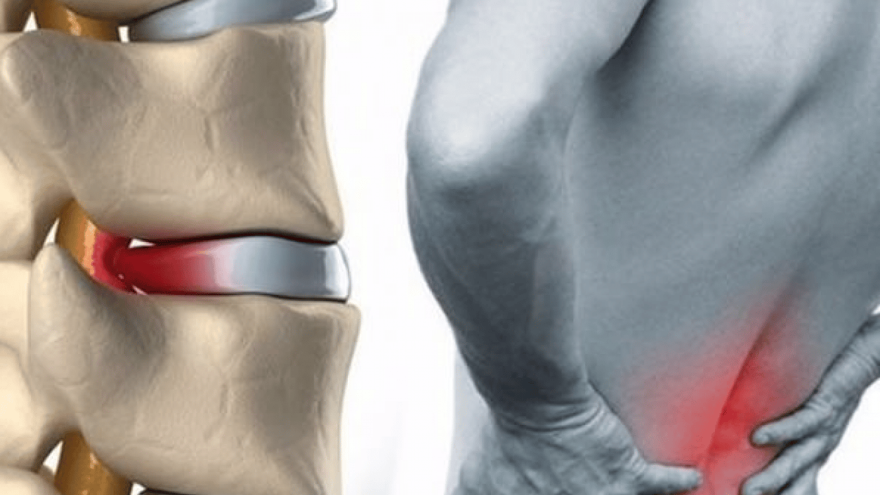 Foto - Ortopedi ve Travmatoloji Uzmanı uyarıyor: Bel ağrısı toplumun yüzde 80'ini etkiliyor