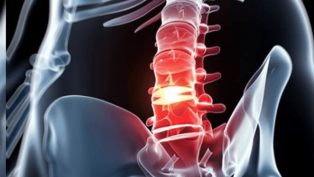 Ortopedi ve Travmatoloji Uzmanı uyarıyor: Bel ağrısı toplumun yüzde 80'ini etkiliyor