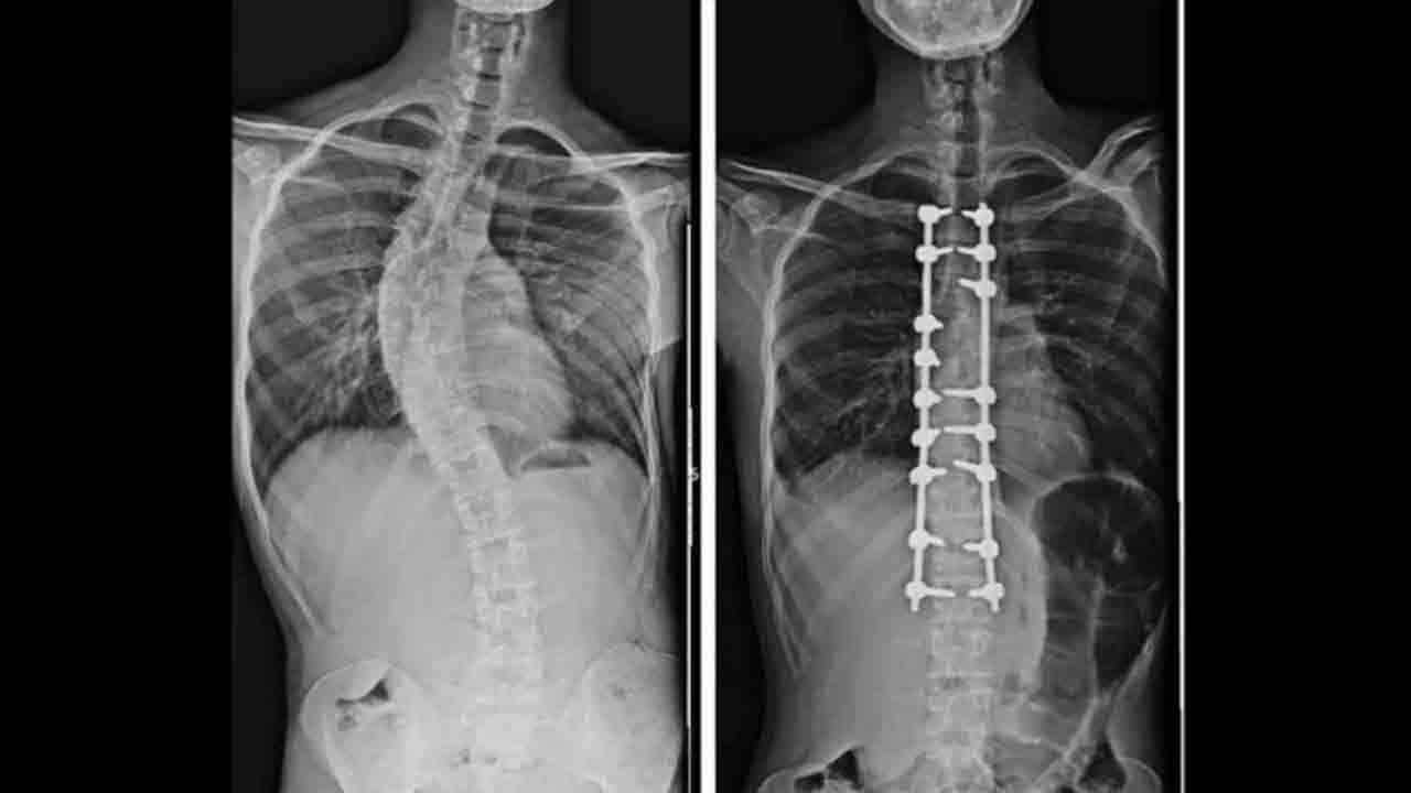 Foto - Ortopedide yapay zekâ dönemi: Robot destekli tedaviyle hata payı azalıyor