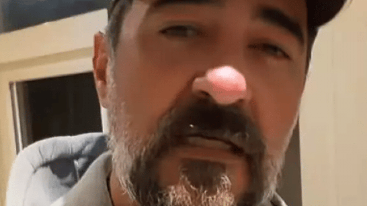 Foto - Oyuncu Celil Nalçakan kaza geçirdi! Görüntüler ortaya çıktı!