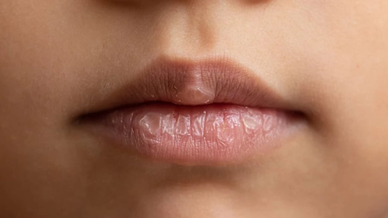 Foto - Pamuk gibi yumuşacık olacak! Çatlayan dudakları kış boyu korumanın doğal yolu