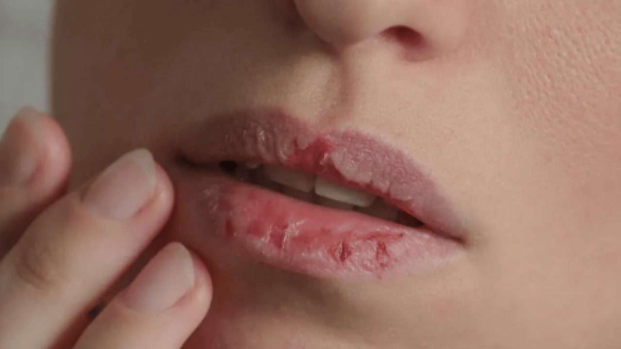 Pamuk gibi yumuşacık olacak! Çatlayan dudakları kış boyu korumanın doğal yolu