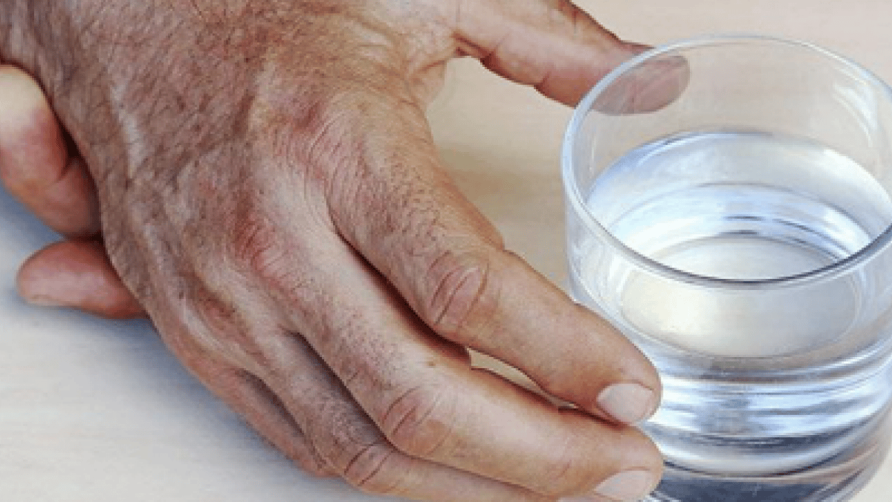 Parkinson, kök hücre tedavisi: Onlarca yıldır rahatsız olanları ilgilendiriyor! Tersine çevrildi! Sonuç duş etkisi yaptı