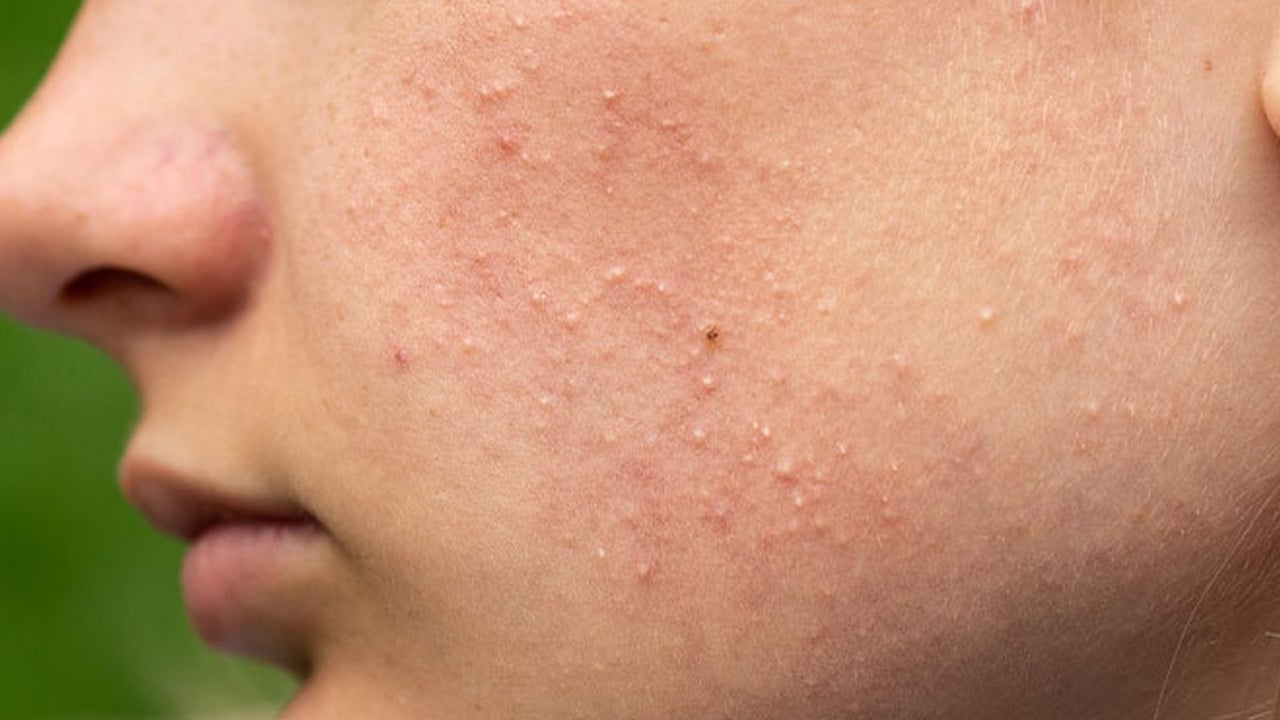 Foto - Patates kabuklarını çöpe atan bin pişman: Her evde var ama biz bunları bilmiyoruz! 