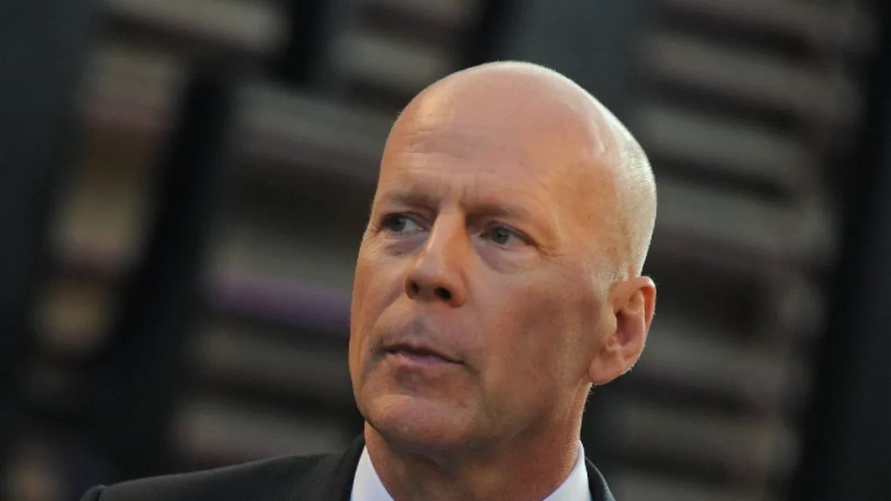 Foto - Bruce Willis’in beyni bağışlanacak... Demans nedir?