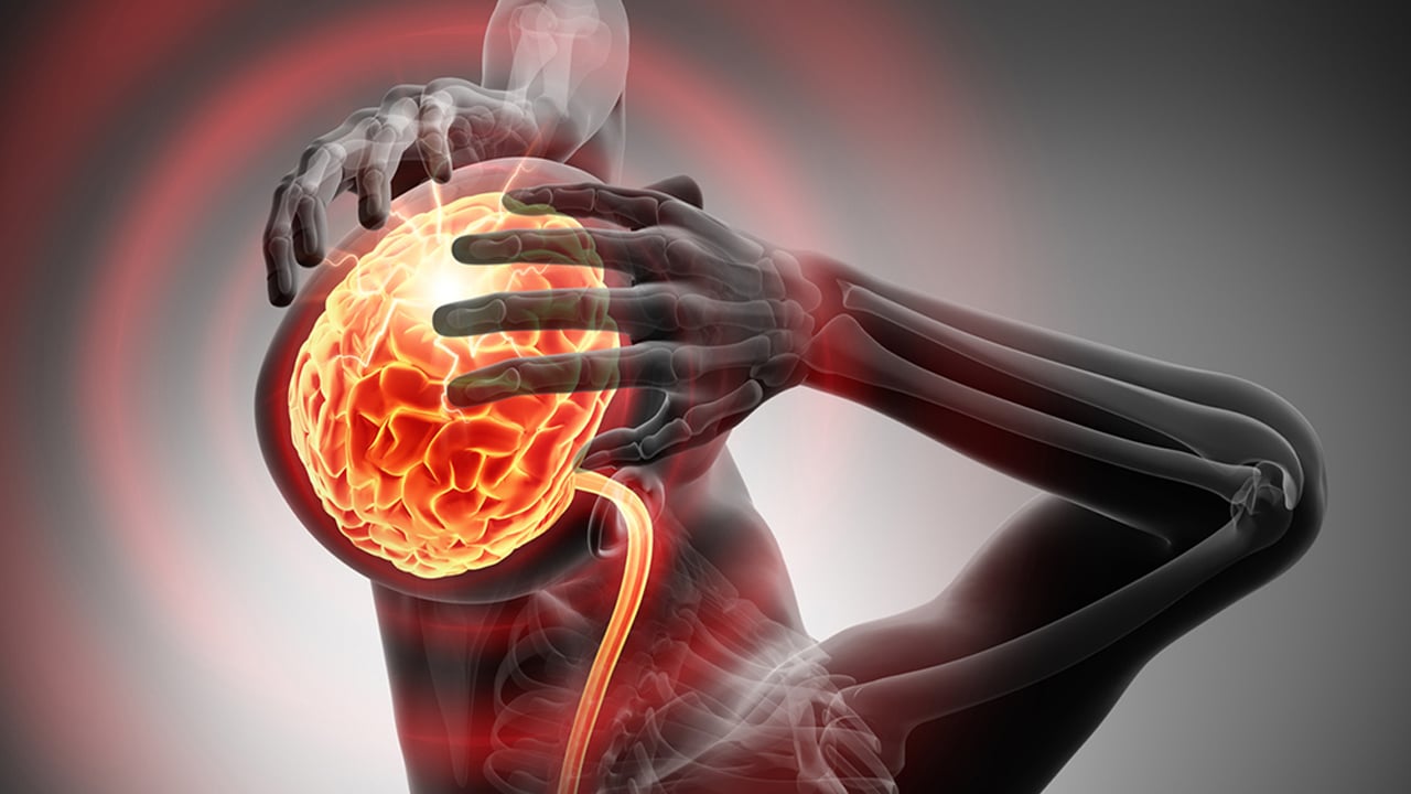 Foto - Peş peşe şiddetli baş ağrısı - Görme kaybı beyin tümörünün erken işareti olabilir, dikkat edin 