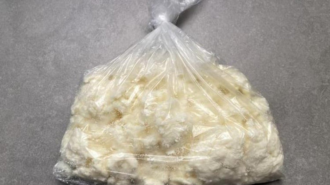 Foto - Peynir böbrekleri tehdit ediyor! Uzmanlardan dikkat çeken uyarı