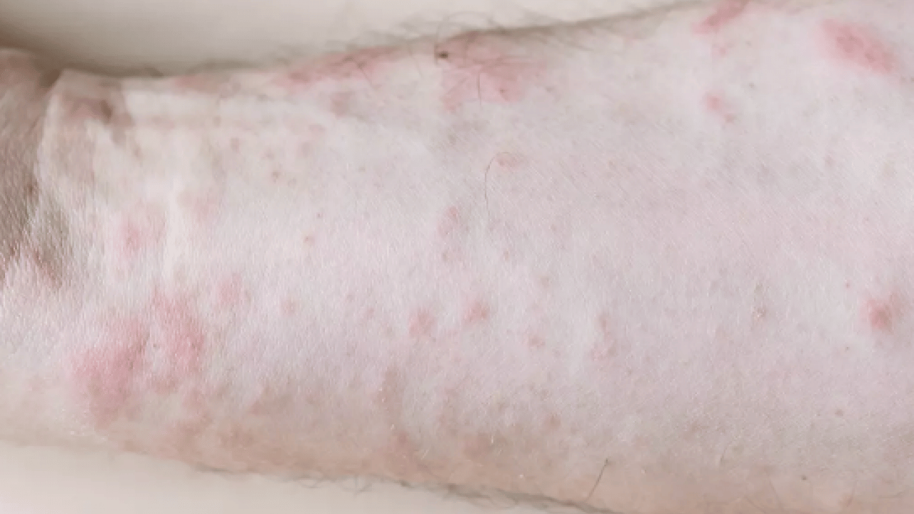 Foto - Yarardan çok zarar vermeyin... pH 5,5 dengesine dikkat! Hangi sabun hangi cilt tipine iyi gelir? 