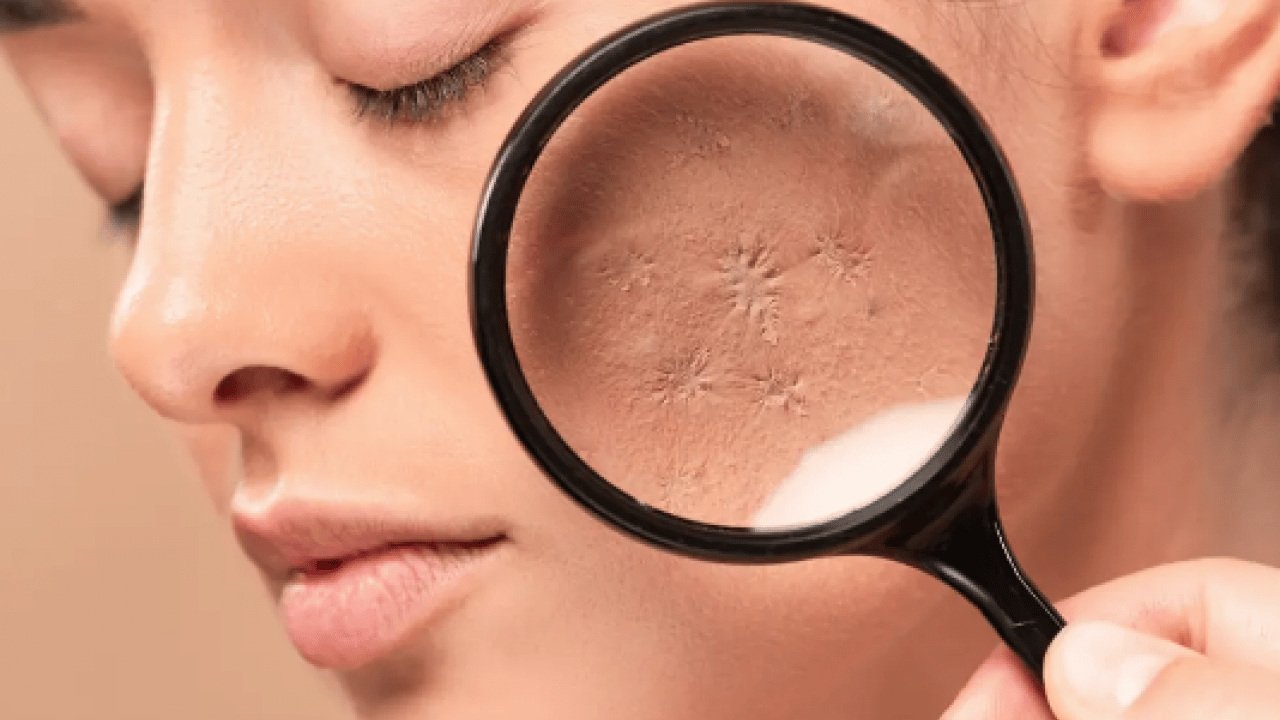 Foto - Yarardan çok zarar vermeyin... pH 5,5 dengesine dikkat! Hangi sabun hangi cilt tipine iyi gelir? 